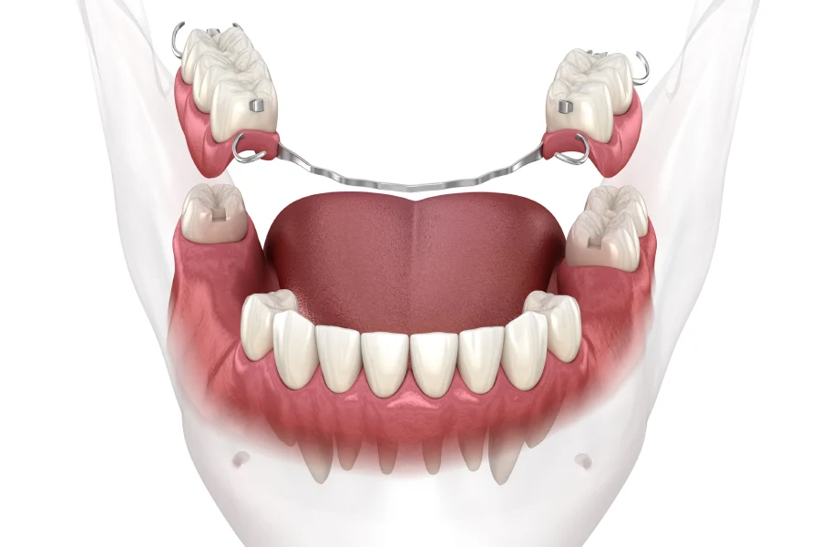 How To Adjust To New Denture Services Comfortably in Petersburg, VA