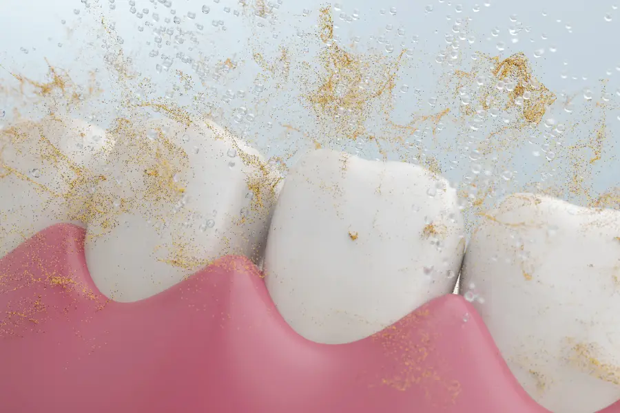 Understanding What Happens During a Dental Cleaning in Petersburg, VA