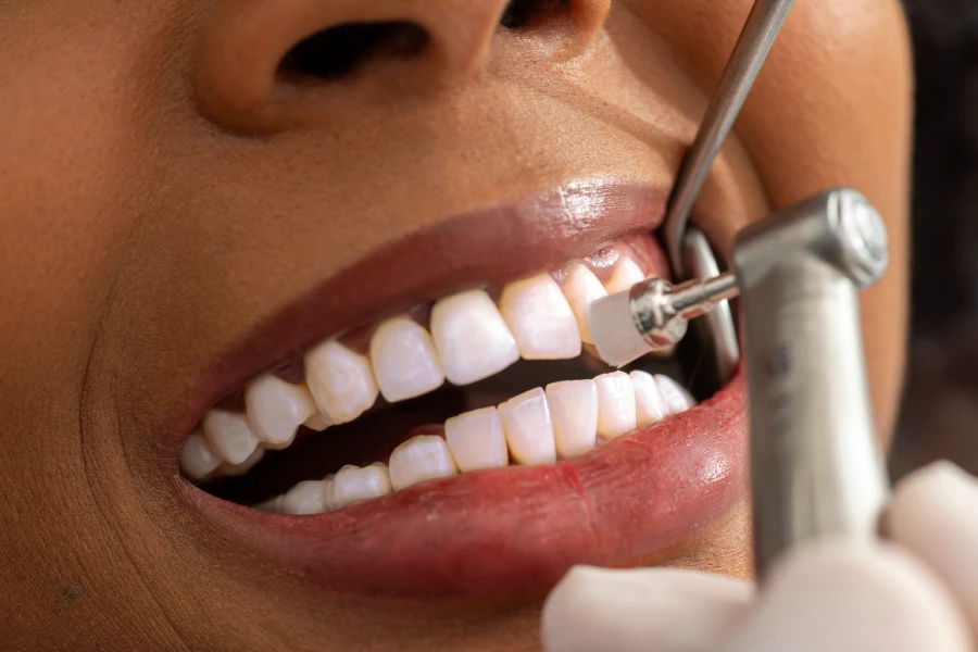 Reliable Dental Cleaning in Petersburg, VA